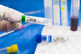 HIV-Reisebeschränkungen: Überprüfen Sie die betroffenen Länder